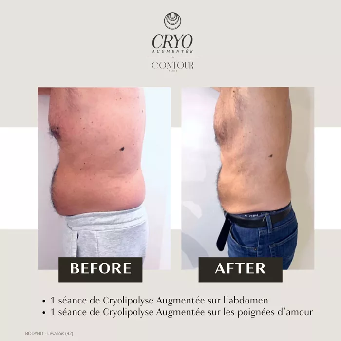 bel-oceane-minceur-1303262