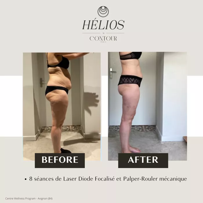 bel-oceane-minceur-1303263